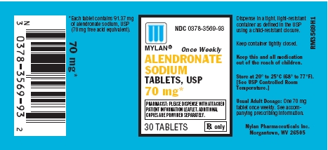 Alendronate Sodium Tablets 70 mg